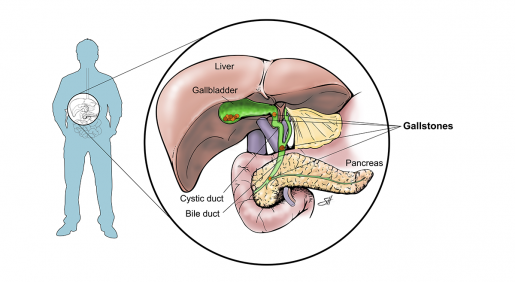 An illustration of the gallbladder and where it is in the human body