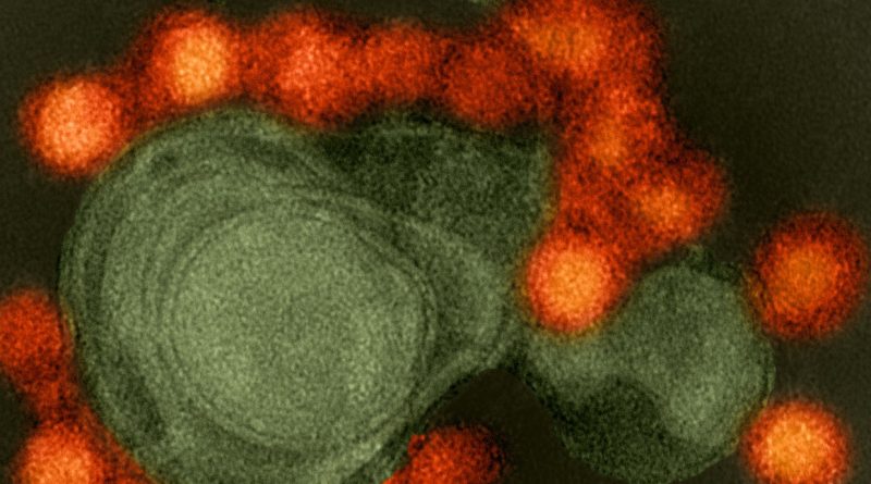 Transmission electron microscope image of negative-stained, Fortaleza-strain Zika virus.