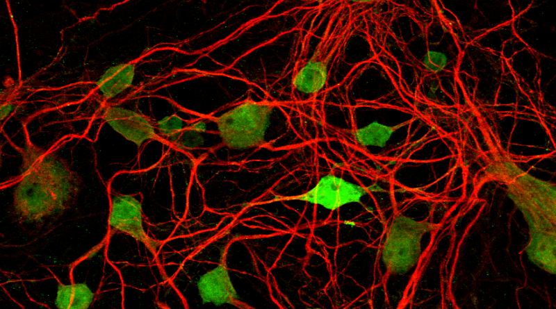 Web of red with green splotches show neural connections in the visual pathway of the brain