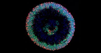 Image of the Month: Human retinal organoid