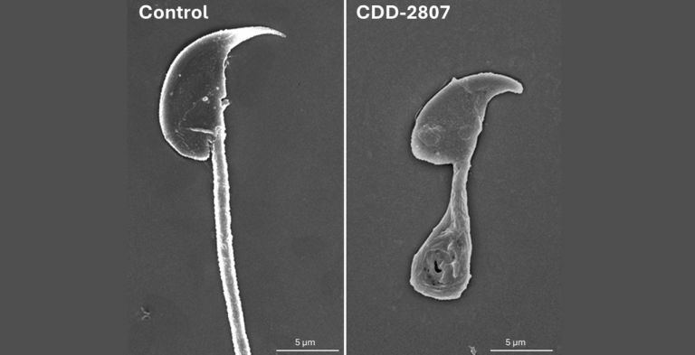 An electron microscope image of mouse sperm on the left with defective mouse sperm on the right.