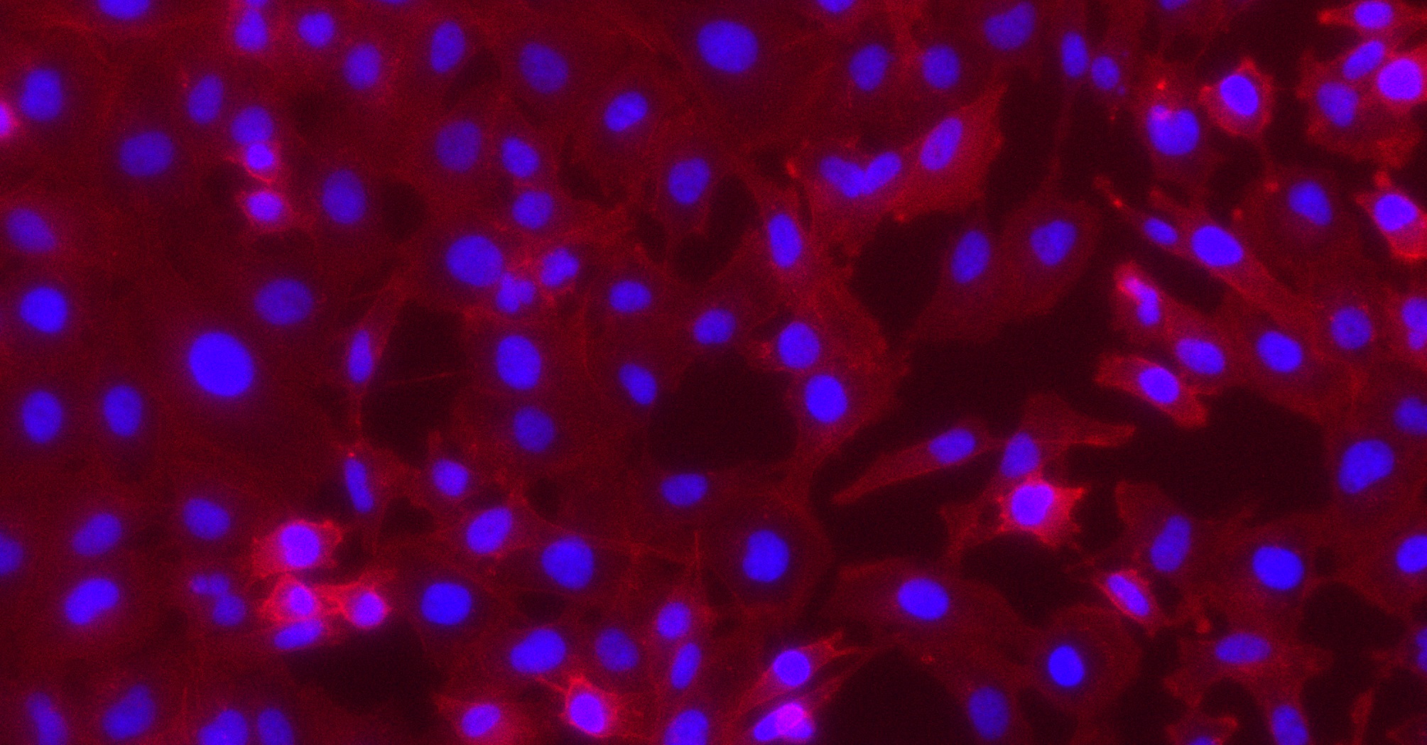dapk3-emerges-as-a-new-regulator-of-migration-of-triple-negative-breast
