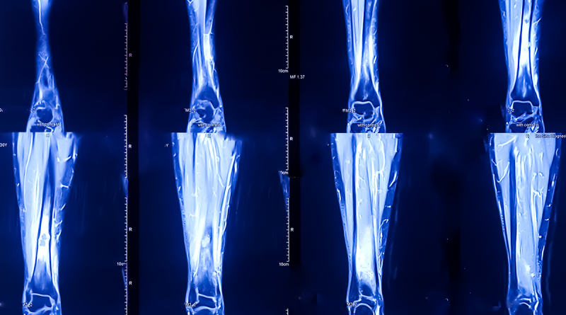 A series of x-rays of bones.