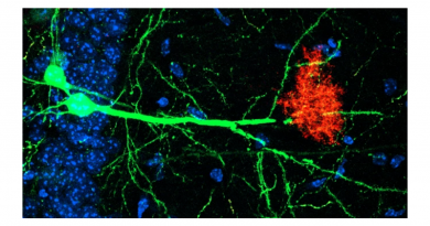 Microscopic image of neurons reaching toward and a cloud of astrocytes.