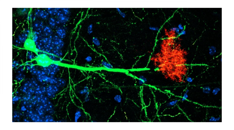 Microscopic image of neurons reaching toward and a cloud of astrocytes.