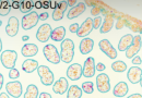 Rotavirus protein NSP4 manipulates gastrointestinal disease severity