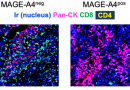 How MAGE-A4 helps tumors evade immune responses crucial for their elimination