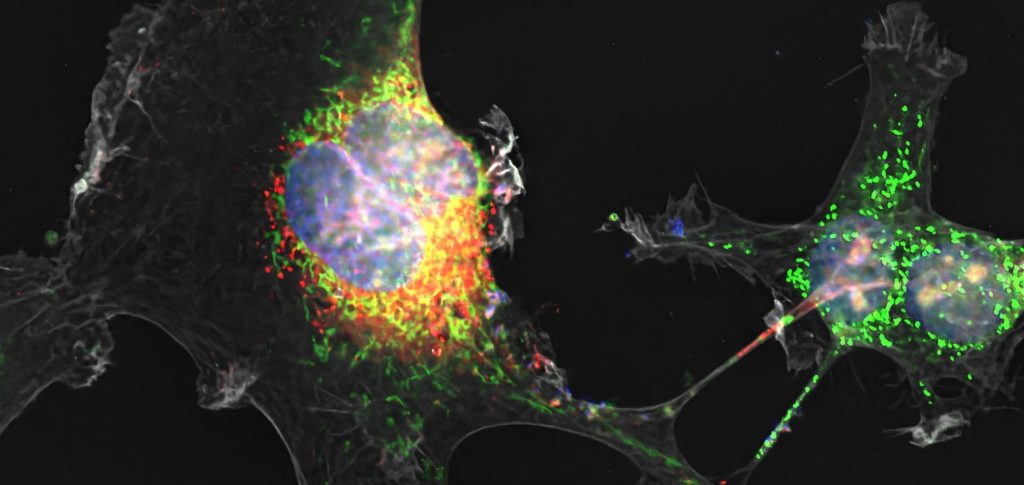 Zika virus's protein NS1 (red) and mitochondria (green) travel through tunneling nanotubes (TNT, gray) from infected to uninfected placental cells.