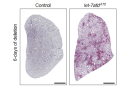 Let-7 is key to keep pulmonary fibrosis in check