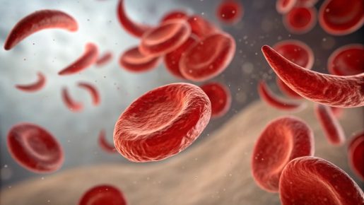 Close up of normal and sickle cell disease blood cells