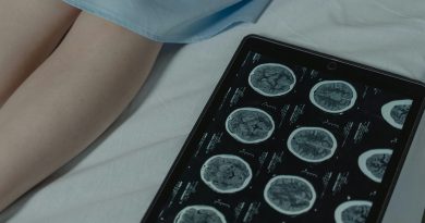 A novel source of genetic variation influencing childhood brain tumors
