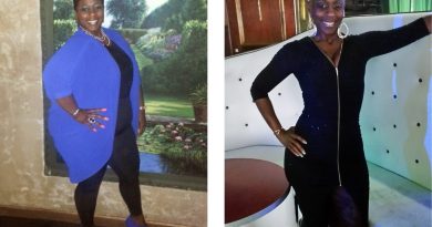 Sherry Matchett posing before and after weight loss surgery.