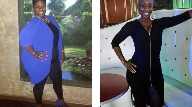 Sherry Matchett posing before and after weight loss surgery.