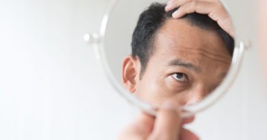 Man checking for hair loss.