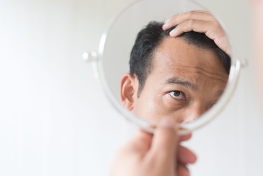 Man checking for hair loss.