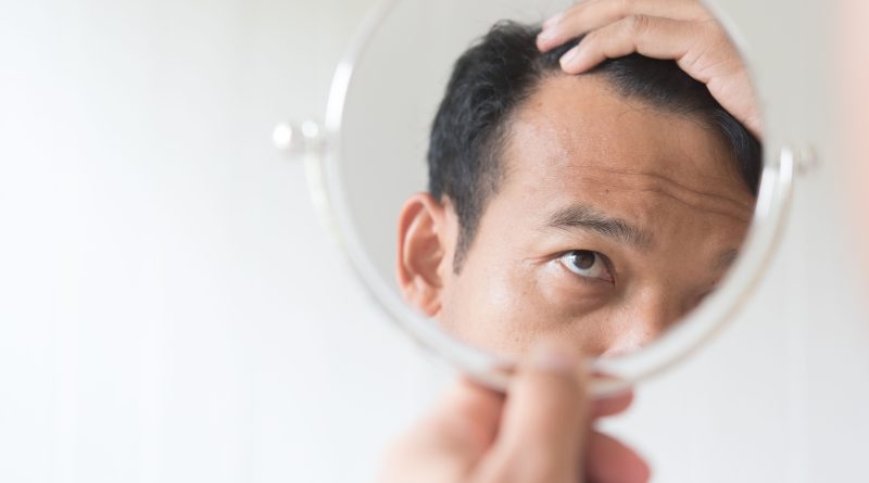 Man checking for hair loss.