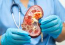 Doctor holds kidney model.