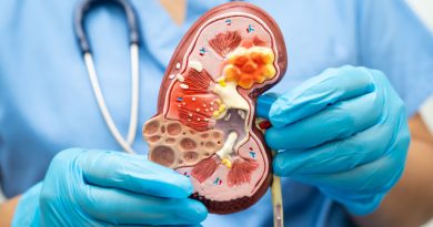 Doctor holds kidney model.