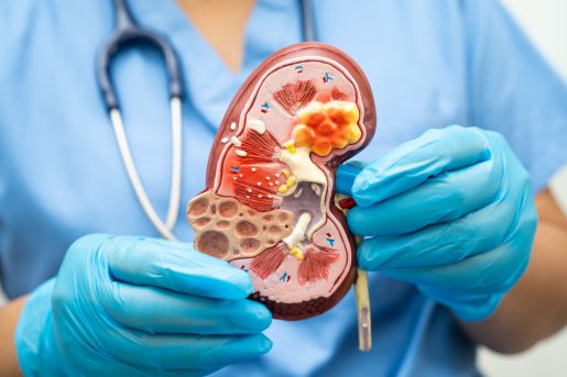 Doctor holds kidney model.