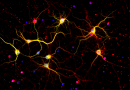 Close up of neurons from the brain cortex of a mouse with Huntington's disease.