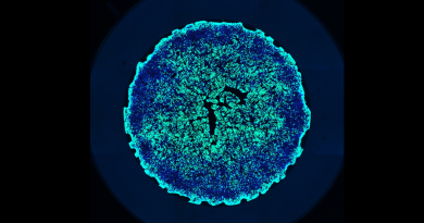 FROM THE LABS: Image of the Month: Human intestinal organoid