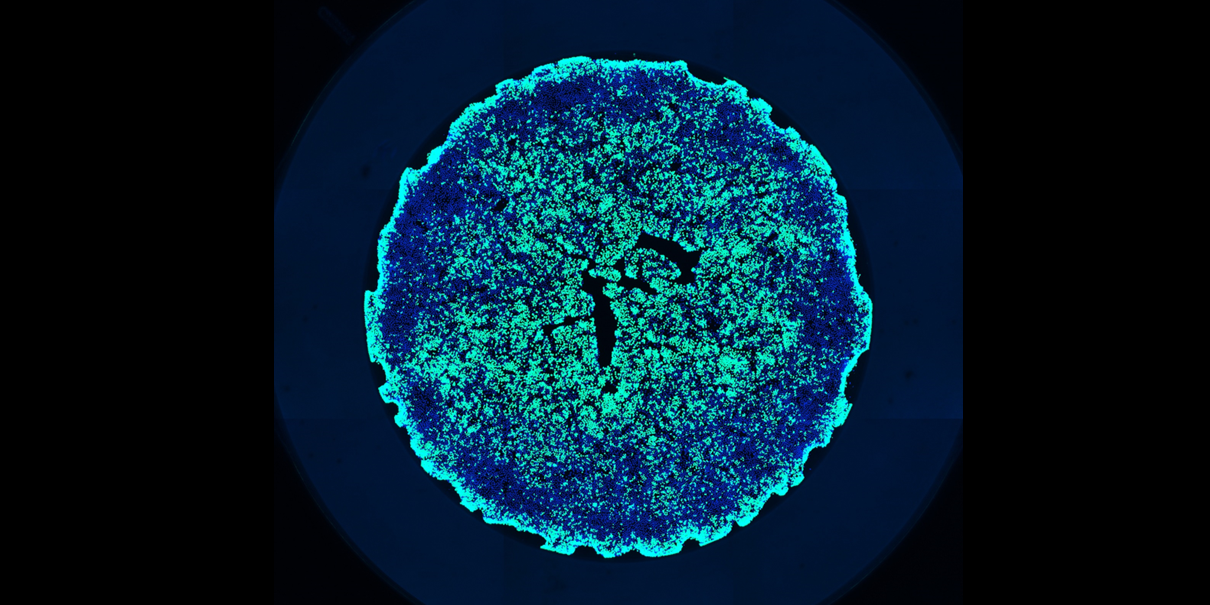 Close up of neurons from the brain cortex of a mouse with Huntington's disease. 