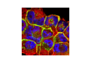 Image of the Month: Breast cancer cell clusters Image of the Month: Breast cancer cell clusters