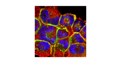 FROM THE LABS: Image of the Month: Breast cancer cell clusters