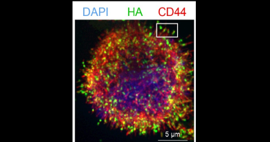 FROM THE LABS: A ‘sticky situation’ boosts triple negative breast cancer’s ability to metastasize