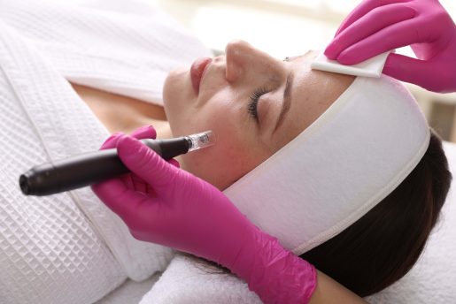 Woman undergoing microneedling.