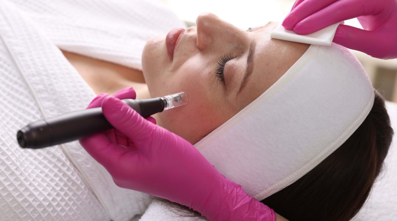 Woman undergoing microneedling.