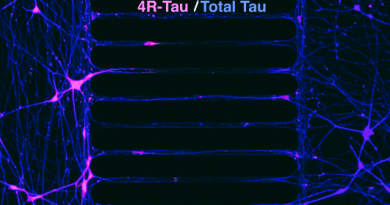 Image of the Month: Tau travels between neurons