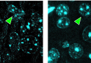 Diet remodels chromatin structure and extends survival in models of glioma