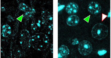 FROM THE LABS: Diet remodels chromatin structure and extends survival in models of glioma