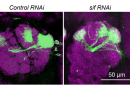 Researchers uncovered a novel pathway that causes epilepsy