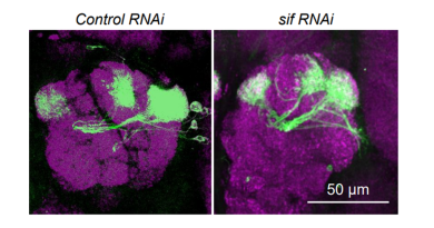 Researchers uncovered a novel pathway that causes epilepsy