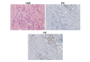 Genome editing in rats enables more accurate ER+ breast cancer models