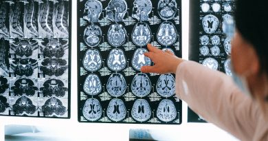 A closer look at brain tissue vulnerability in neurological disease