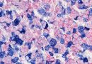 Genome editing in rats enables more accurate ER+ breast cancer models