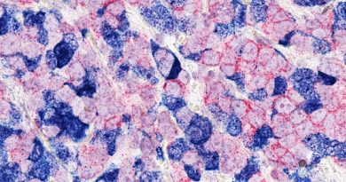 Genome editing in rats enables more accurate ER+ breast cancer models