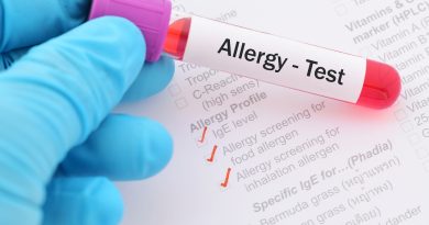 Close-up of a gloved hand holding a blood sample tube labeled “Allergy-Test” above a medical allergy testing form. The form includes checked boxes for IgE level testing and allergy screening for food and inhalant allergens, illustrating allergy diagnosis and laboratory testing.