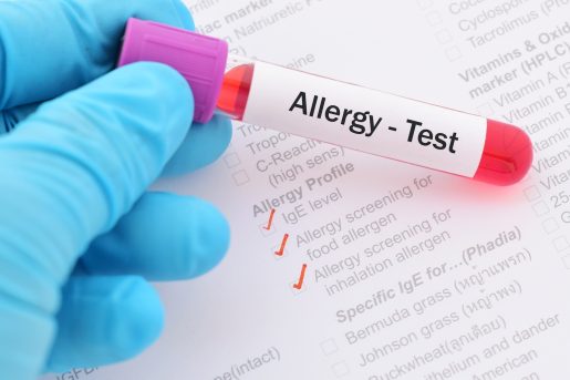 Close-up of a gloved hand holding a blood sample tube labeled “Allergy-Test” above a medical allergy testing form. The form includes checked boxes for IgE level testing and allergy screening for food and inhalant allergens, illustrating allergy diagnosis and laboratory testing.